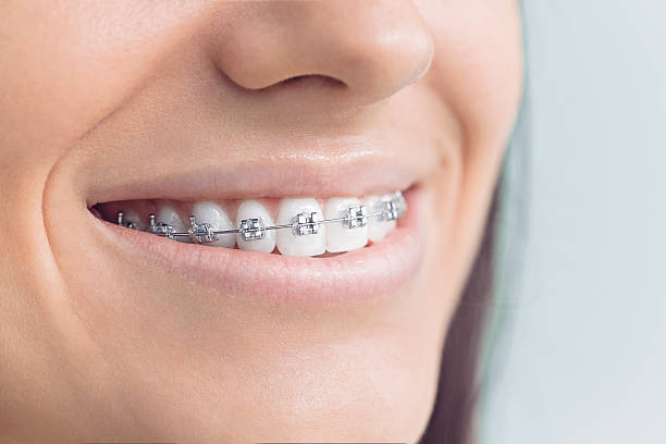 Best Dental Fillings (Composite and Amalgam)  in Palermo, NJ